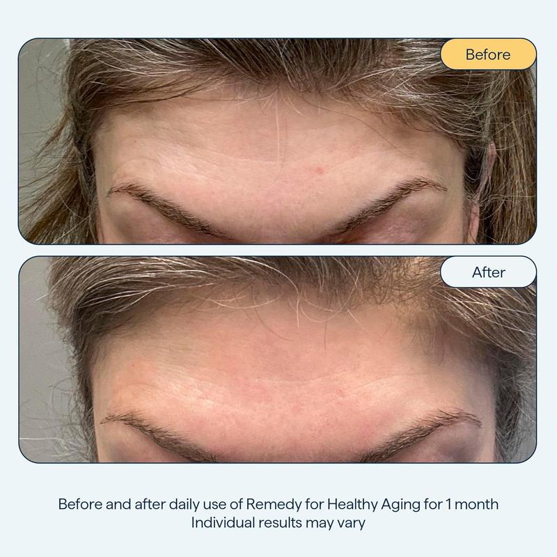 Remedy for Healthy Aging - Treatment for Wrinkles, Uneven Texture & Tone with Retinol, Argireline, Matrixyl 3000, Ceramides, Resveratrol, Ferulic Acid - By Dermatologist Dr. Shah