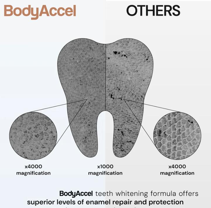 BodyAccelTeeth Whitening Strips