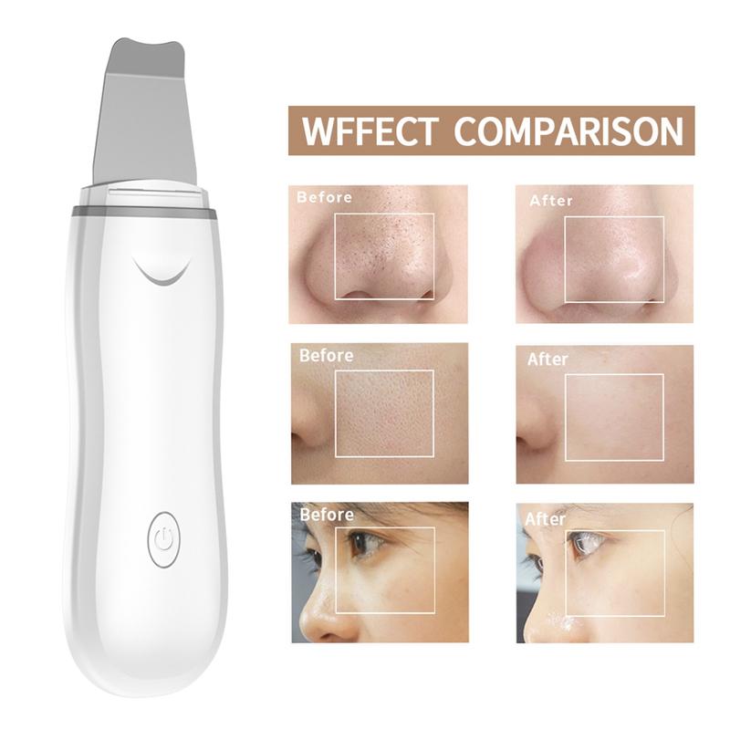 Skin Scrubber Face Spatula Facial Skin Exfoliator Scraper and Blackhead Remover Pore Cleaner Face Lifting Tool Comedones Extractor for Facial Deep Cleansing