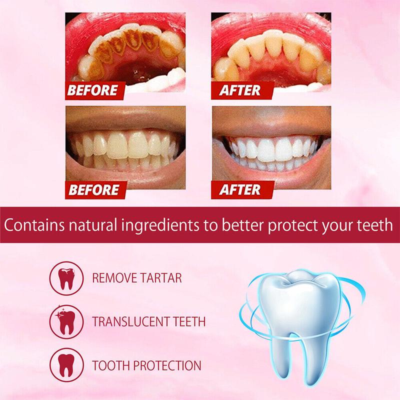 YAYASHI SP4 Probiotics Teeth Whitening,Helps Remove Surface Stains,Whitens Teeth,Deep Cleaning Care,Strengthens Tooth Enamel,Protects Against Cavities healthy toothpaste pasta dental oral health natural oral