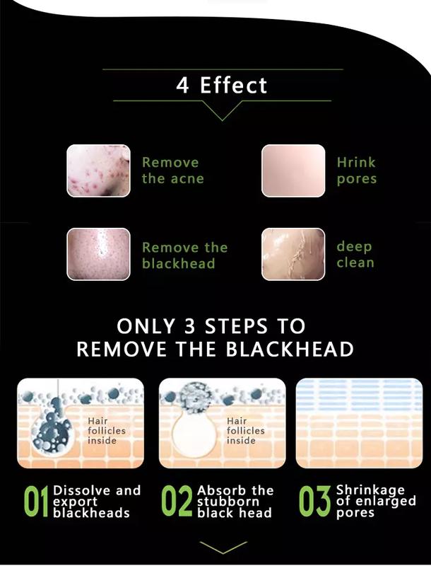 Unisex Blackhead Remover Mask Kit,Charcoal Peel Off Facial Mask withBrush and Pimple Extractors, DeepCleansing for Face Nose BlackheadPores Acne, For All Skin Types Skincare Skin Repair Comfort green  mask facial sheet