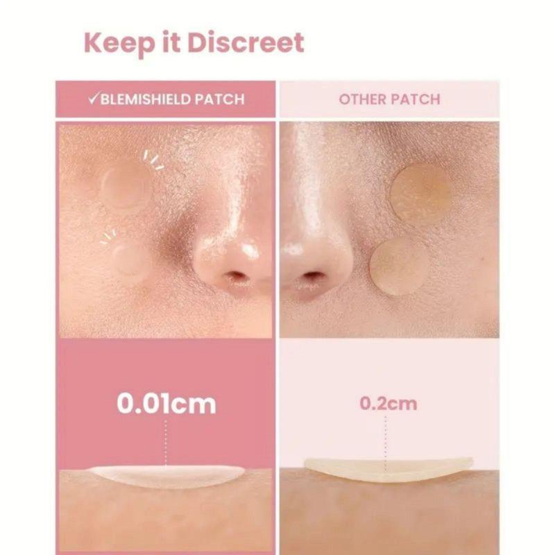 Invisible Acne Patches, 360pcs box Round Shape Hydrocolloid Acne Cover Patches, Facial Blemish Concealer Stickers, Skin Care Products for Women & Men