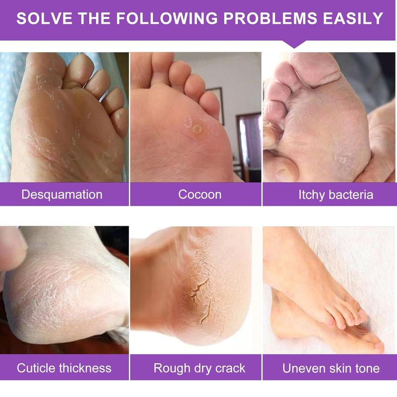 Foot Peel Mask - 5 Pack, Exfoliating Foot Care Mask Make Feet Baby Soft Skin, Foot Mask for Dry Cracked Feet, Peeling Away Dead Skin, Calluses - Lavender