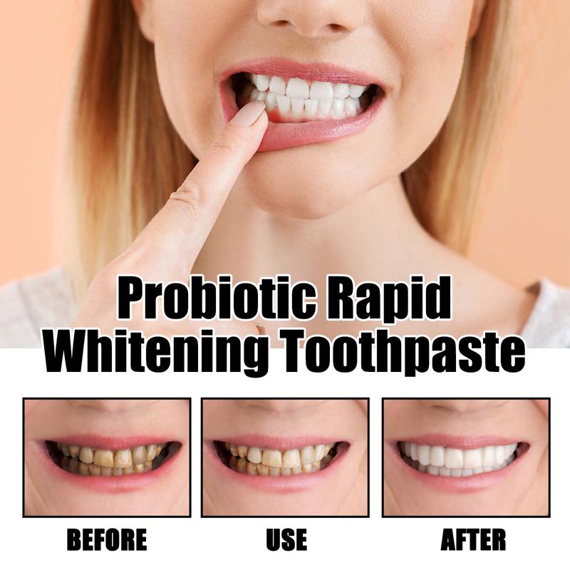 Probiotic Rapid Whitening Toothpaste;Whitening Toothpaste;Probiotic Whitening Toothpaste tooth stain niacinamide toothpaste