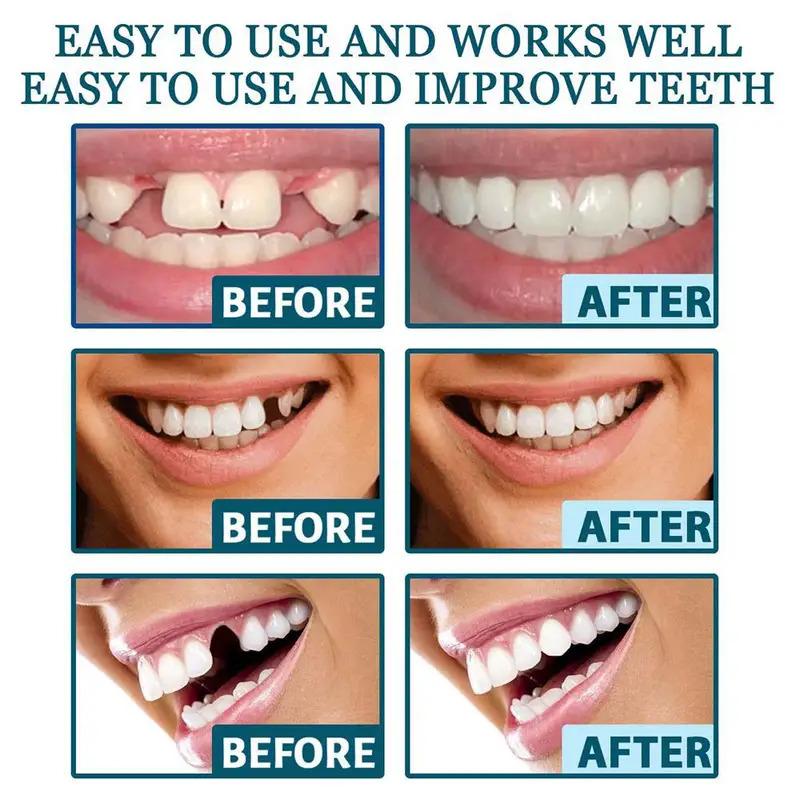 Adjustable Denture Teeth Set Instant Smiling Veneer Denture Tooth Natural Portable Braces Decorate Gaps Between Teeth