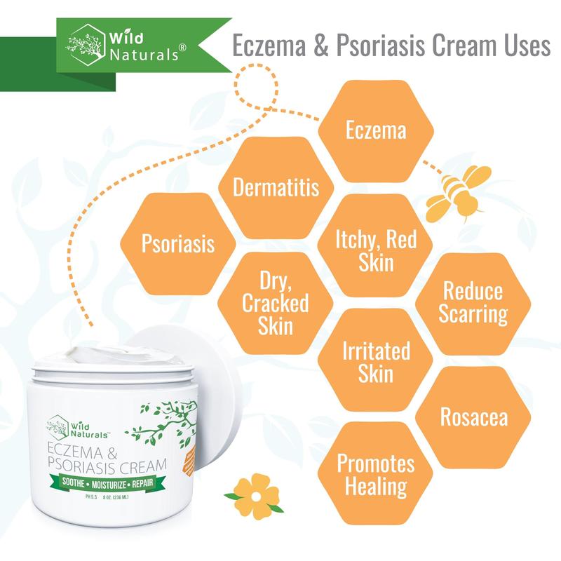 Eczema & Psoriasis Cream - Effective Treatment for Skin Conditions Moisturizer Organic