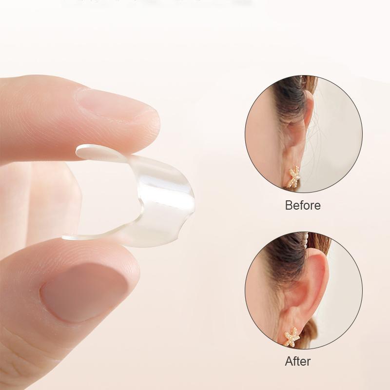 GentleGlow Elf Ear Stickers (12 Pairs) – Invisible, Transparent Silicone Ear Tapes, Comfortable Ear Correction, Perfect for Flat Ears and Facial