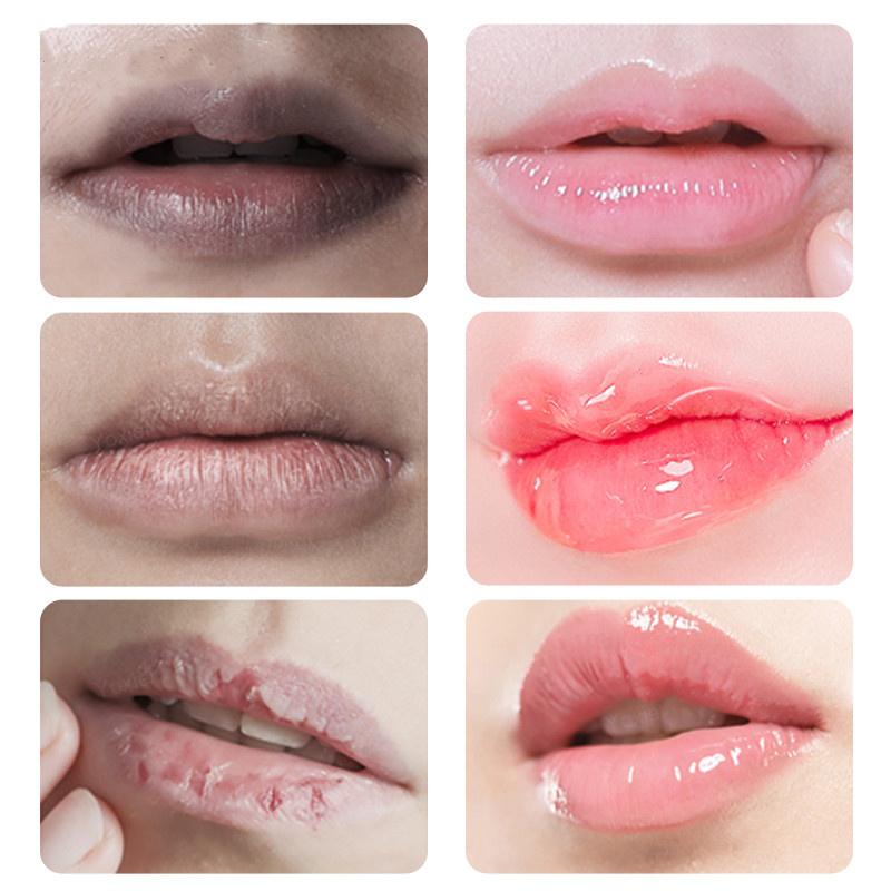 Lips Pink Fresh Lightening Bleaching Cream Treatment Remove Dark Smoke Lips Lip Balm Whitening Moisturizer Nourishing Essence