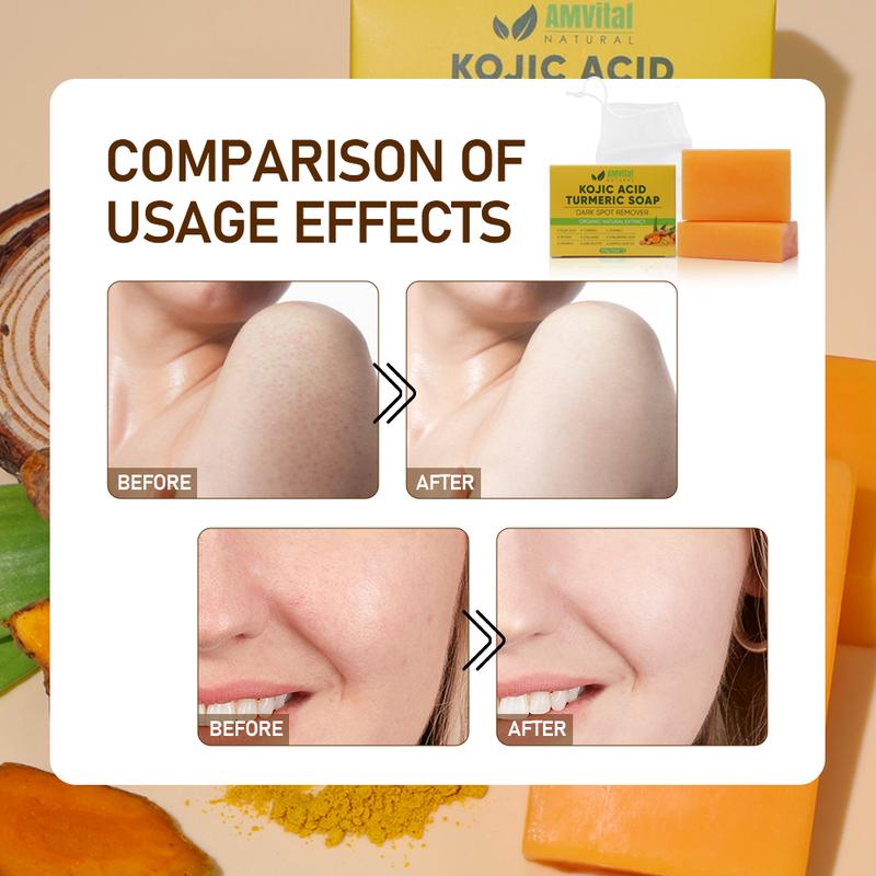 AMVital Turmeric Kojic Acid Moisturizing Soap, Retinol, Collagen,Hyaluronic Acid, Shea Butter  Brightening Kojic Hydrating Moisture Hydrating Moisture