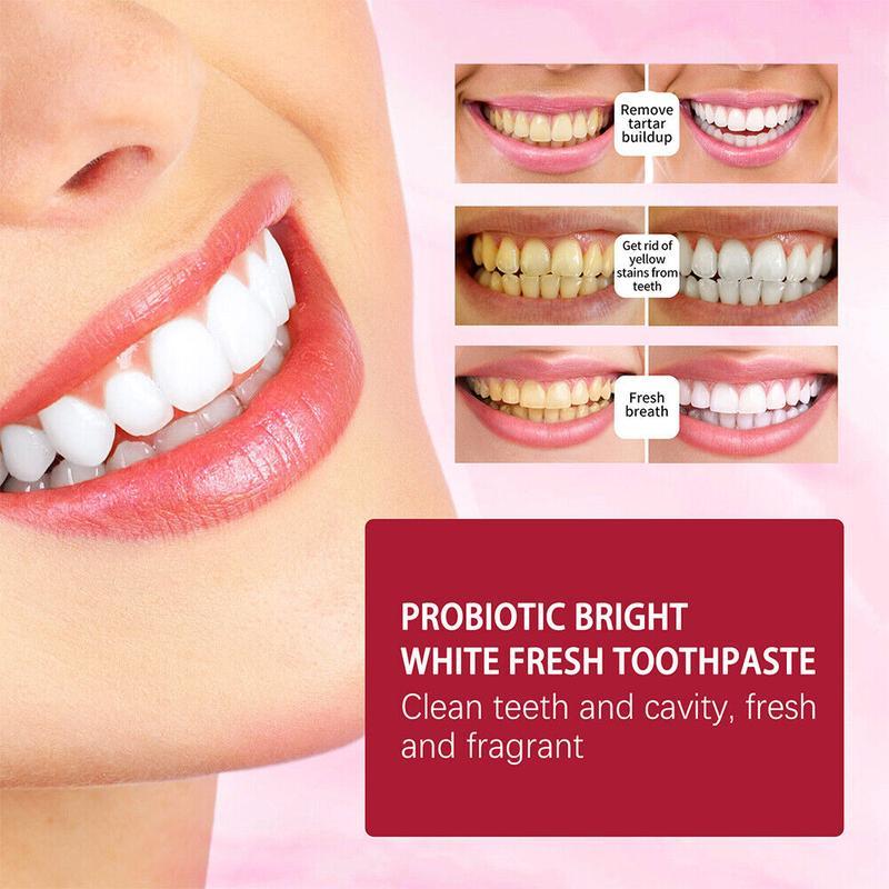 90% Choose SP6 Probiotics Ultra Whitening Toothpaste | Bright White & Fresh Breath | SP-6 Whitening Paste Oral