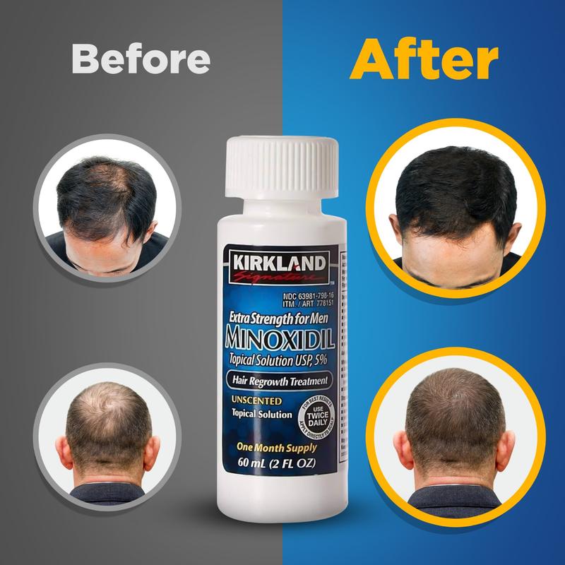 Kirkland Signature Minoxidil Liquid Extra Strength Hair Regrowth Treatment for Men, 5% Topical Solution