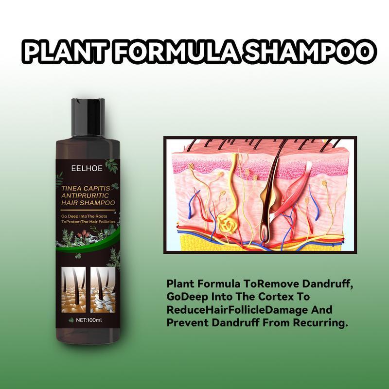 Scalp Repair Biological Shampoo,Anti Itch Dandruff Shampoo,Tinea Capitis Antipruritic Hair Shampoo,Dandruff Treatment Shampoo,Deep into the Roots,Protect the Hair Follicles black  Conditioner Haircare Aloe Comfort Cleanser Cleansing Conditioner Haircare