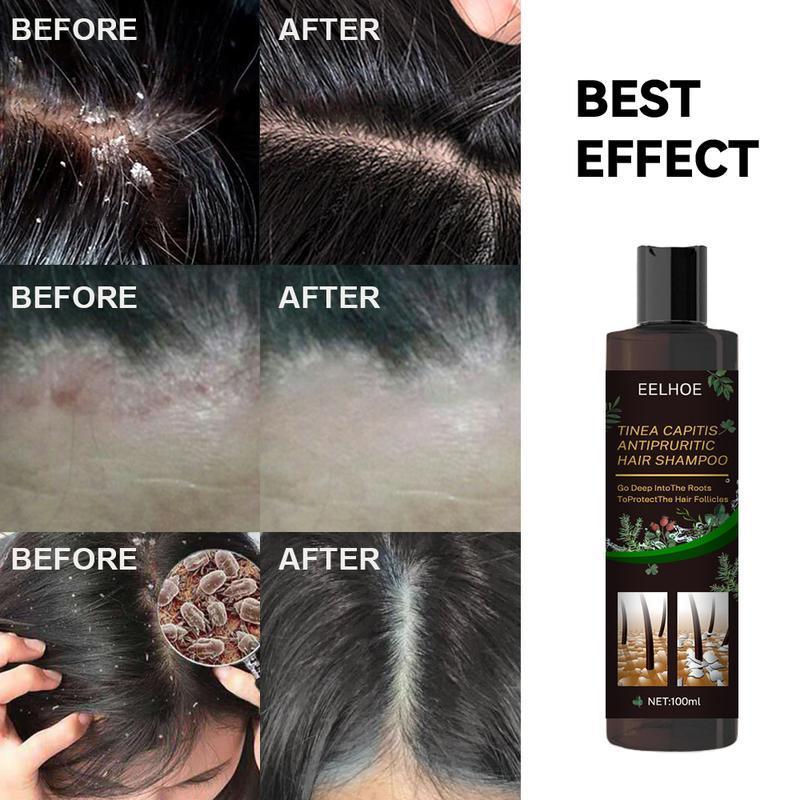 Tinea Capitis Antipruritic Hair Shampoo, Anti-Drop Refreshing Oil Control Hair Conditioner Anti-Dandruff Anti-Itch Shampoo Haircare Aloe Haircare Aloe black  shampoo