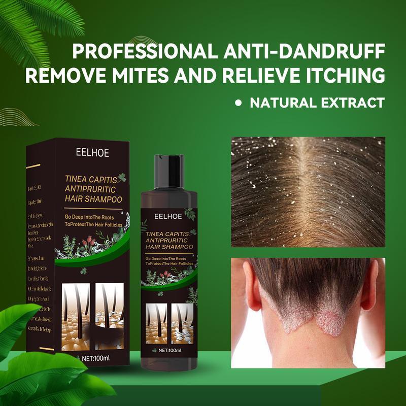 Tinea Capitis Antipruritic Hair Shampoo, Anti-Drop Refreshing Oil Control Hair Conditioner Anti-Dandruff Anti-Itch Shampoo Haircare Aloe Haircare Aloe black  shampoo