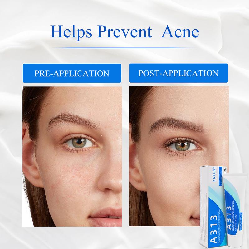 A313 Vitamin A Pommade 200.000 UI - Skin Improvement Cream