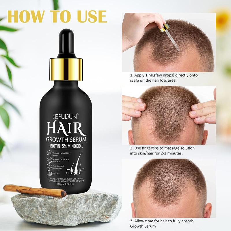 5% Minoxidil Hair Serum, Natural Formula Infused with Herbs, Strengthens Thickens and Fuller Hair, Suitable for Men and Women