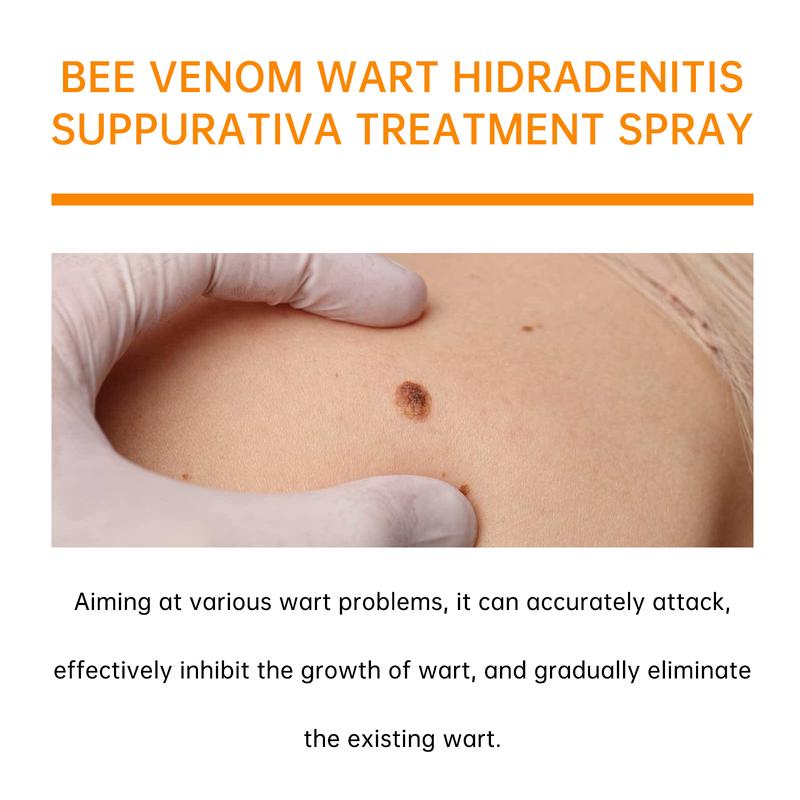 Bee Venom wart and tags removal treatment spray