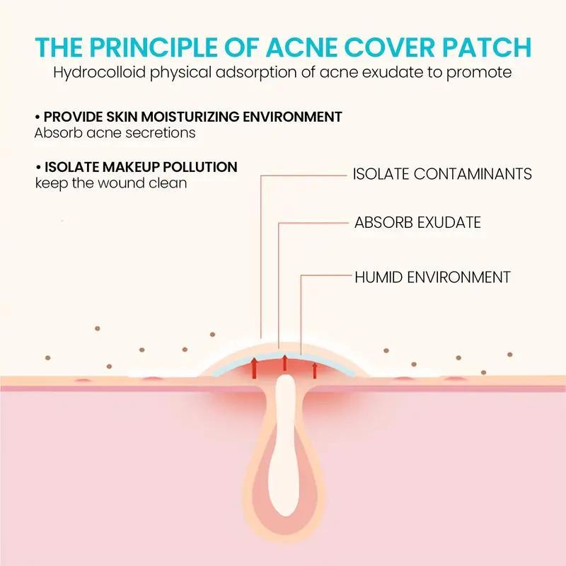 Star Shaped Acne Patch, 600pcs box Hydrocolloid Acne Cover Patch, Waterproof Acne Patches for All Skin Types, Skin Care Products