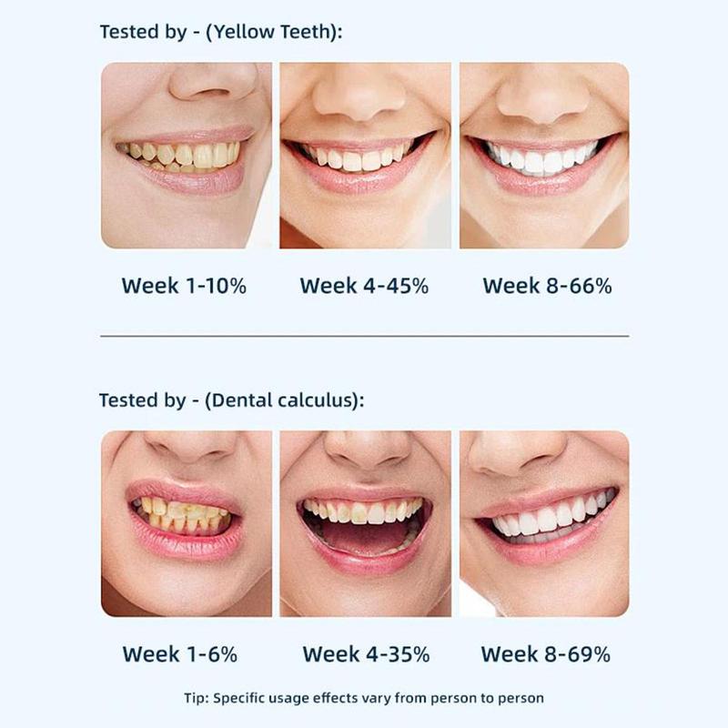 [90% People Choose]Super Probiotic Sp-6 Toothpaste, Sp-6 Ultra Whitening Toothpaste, Sp 6 Toothpaste,Fresh Breath, Sp-6 Toothpaste 4.9 oz SP-10,SP-10 SP-8 SP-4 sp-10 sp-8 sp-4 sp8 sp6 sp4 SP-10