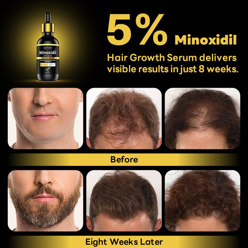 GFTNAT 5% Minoxidil with 5% Rosemary Hair Serum for man and women with Tool