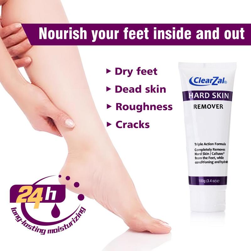 Clearzal Dry  Cracked Feet Repair Ultra-Hydrating Hand and Foot Cream Hard Skin Moisturizer, 3.5 oz. Contains Urea, Salicylic Acid, for Dry, Chapped, Cracked Feet, Dead Skin Remover, For Thick, Cracked, Rough Skin , dead skin and dry skin cream repair