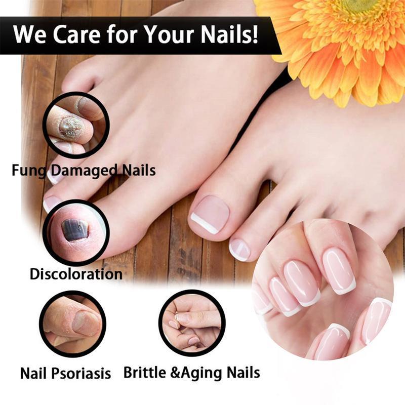 [Free Shipping]Nail Care Moisturizer+ Healmuse Fungal Prevention Solution.Nail Health Care Solution with Tea Tree Oil, Nail Care. Nail Art. Comfort. nail support