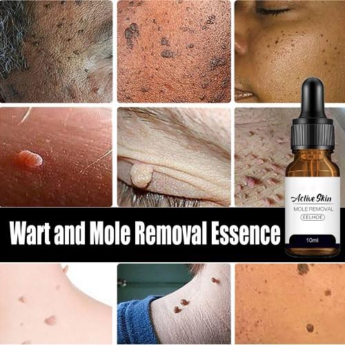 EELHOE Mole & Wart Remover Skin Repairing Cleansing Treatment Serum