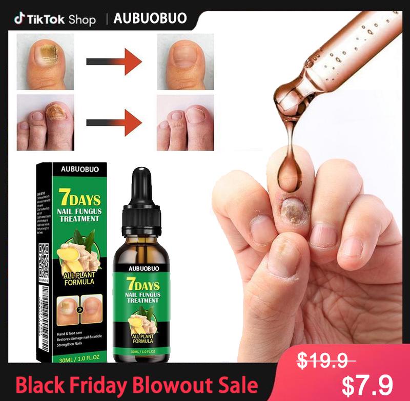 [Black Friday] AUBUOBUO Ginger Nail Treatment Nail Support Nail Care